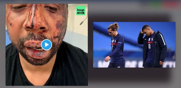 Griezmann, Mbappé… Les sportifs réagissent aux images du producteur tabassé