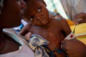 10 millions d’enfants exposés à la malnutrition…